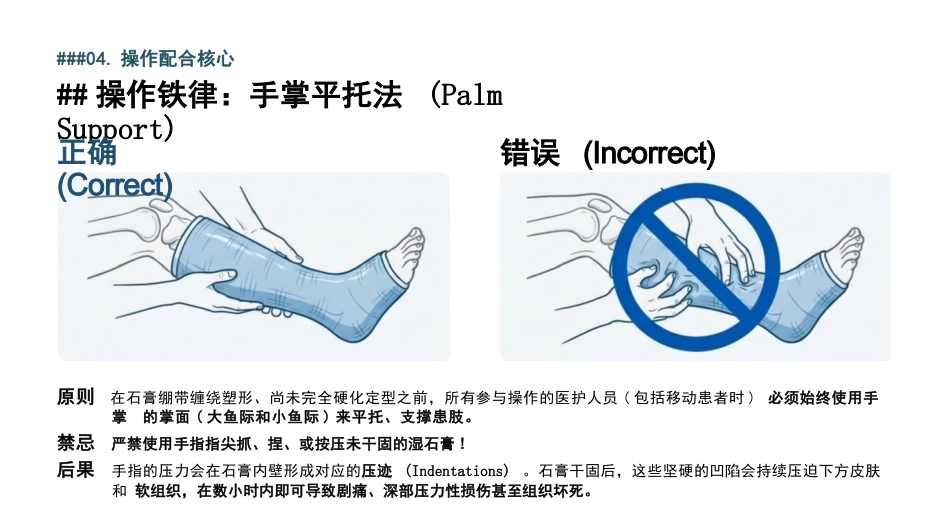 石膏固定术的护理查房_第8页
