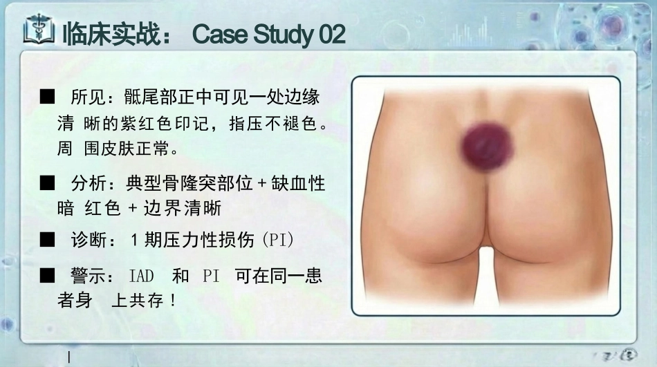 失禁性皮炎预防与护理_第12页