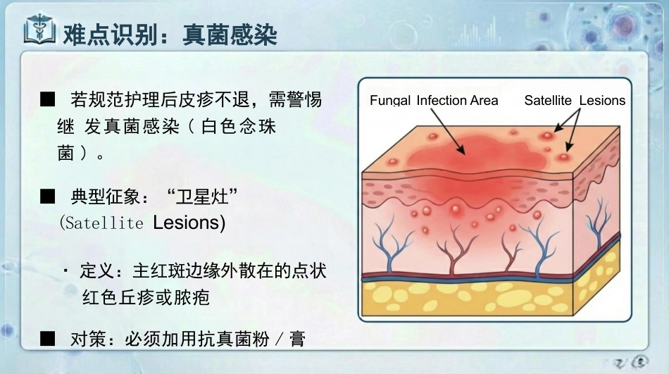 失禁性皮炎预防与护理_第9页