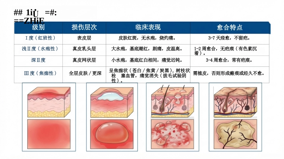 烧烫伤的现场急救与护理_第6页