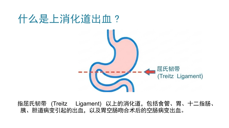 上消化道出血护理查房_第4页