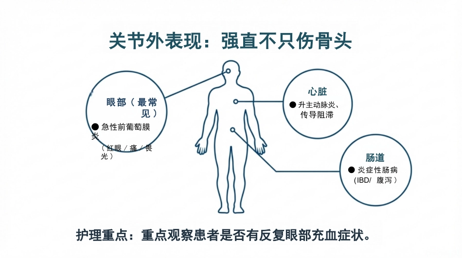 强直性脊柱炎护理查房_第9页