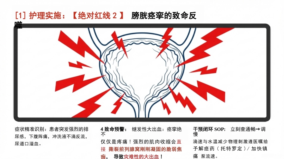 前列腺切除护理查房_第14页