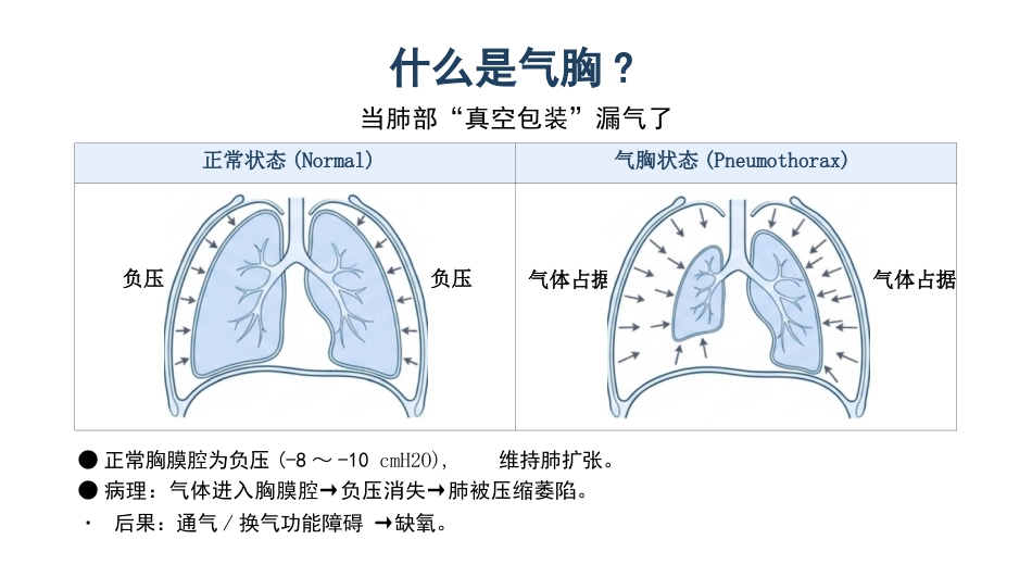 气胸知识科普护理_第3页