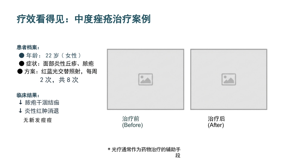 皮肤科红蓝黄光治疗护理_第13页