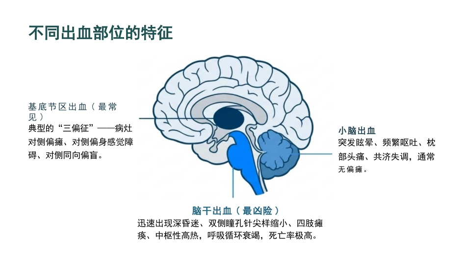 脑出血病人的护理查房_第7页