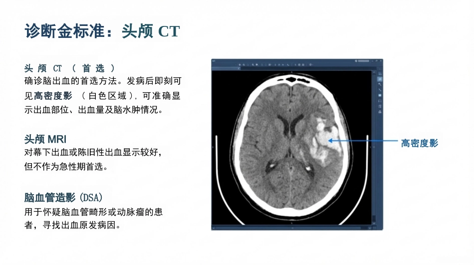 脑出血病人的护理查房_第8页