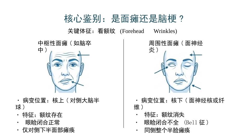 面神经炎诊疗与分期康复进展_第4页