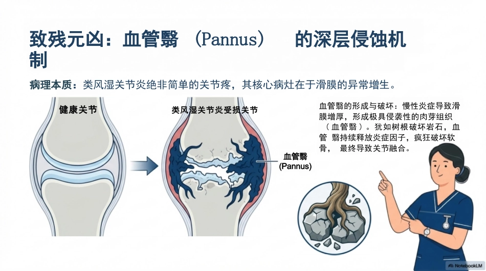 类风湿关节炎护理查房_第7页