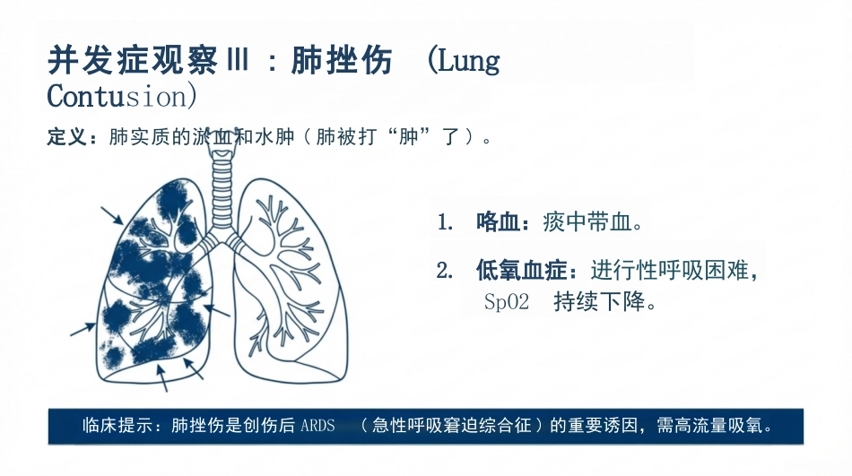 肋骨骨折的观察与护理_第13页