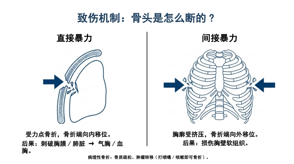 肋骨骨折的观察与护理_第4页