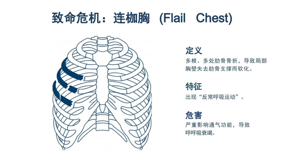 肋骨骨折的观察与护理_第6页
