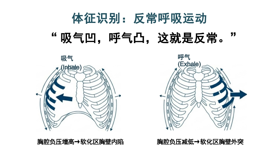 肋骨骨折的观察与护理_第7页