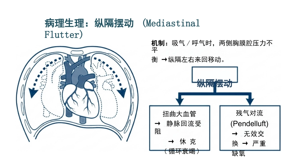 肋骨骨折的观察与护理_第8页
