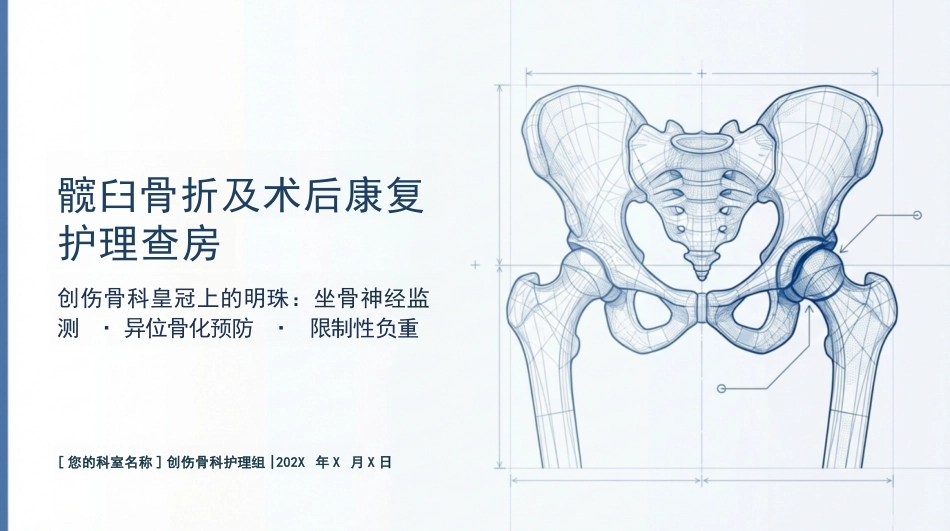 髋臼骨折护理查房_第1页