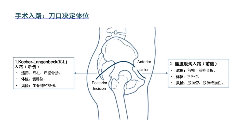 髋臼骨折护理查房_第10页