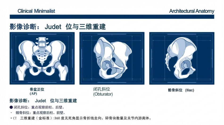 髋臼骨折护理查房_第6页
