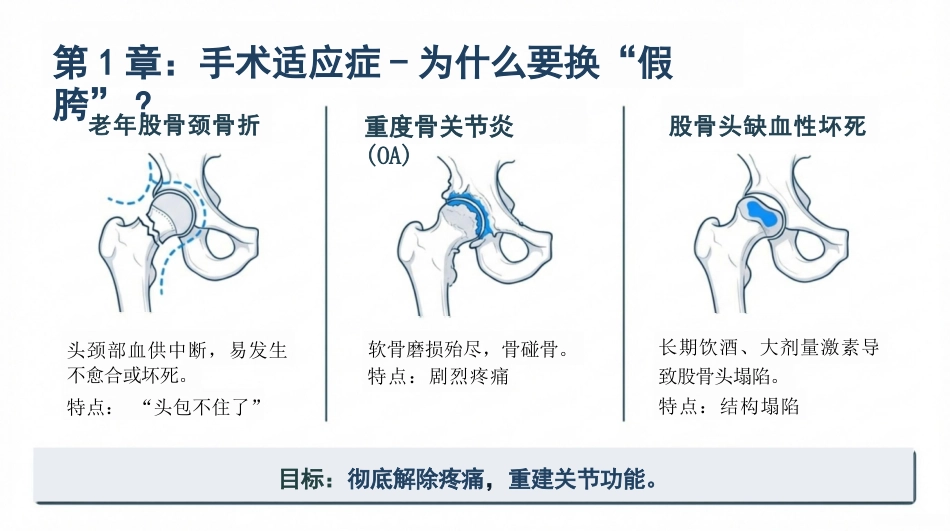 髋关节康复护理查房_第4页
