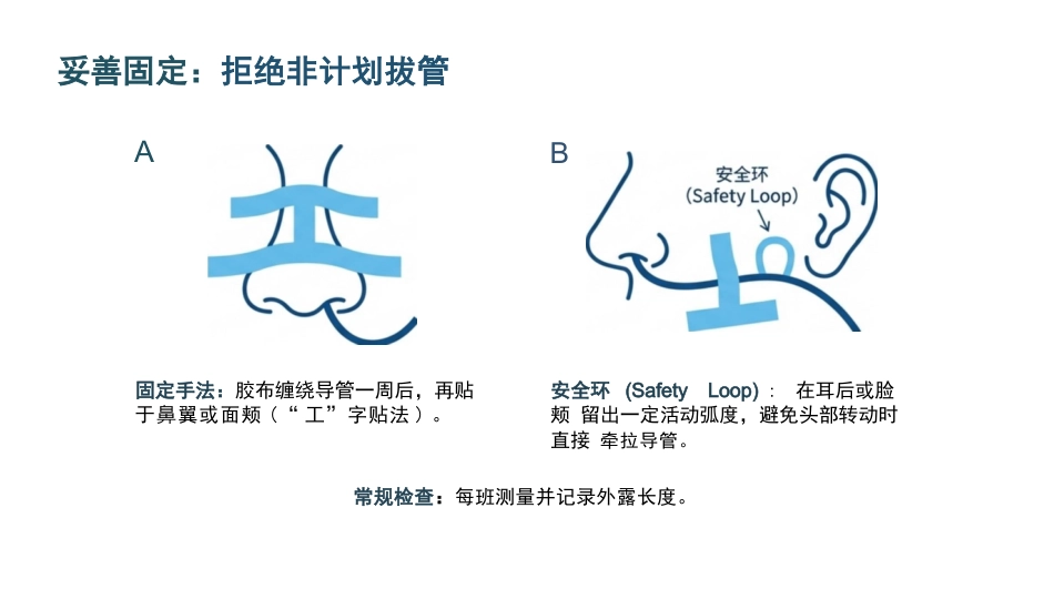 空肠营养管的标准化护理与并发症防空_第14页