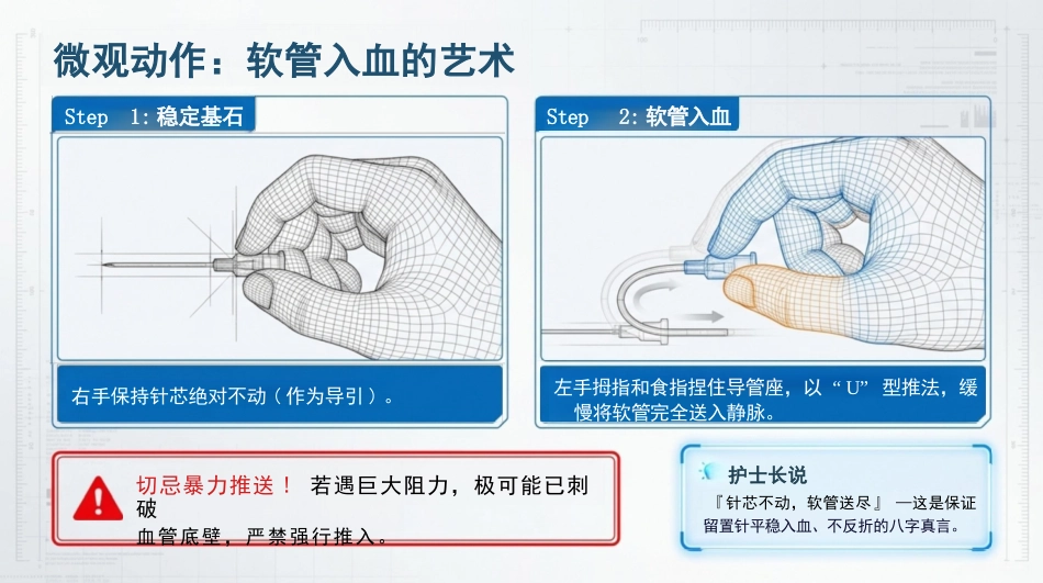静脉留置针操作与维护_第10页