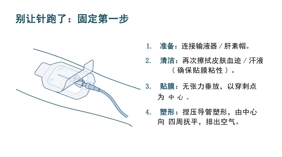 静脉穿刺高级实务精讲_第15页