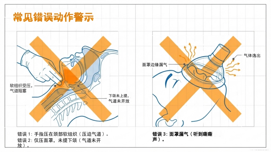 简易呼吸器的使用与维护_第12页