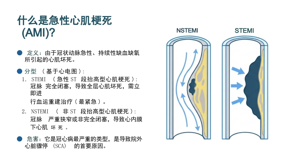 急性心肌梗死的急救与护理_第3页