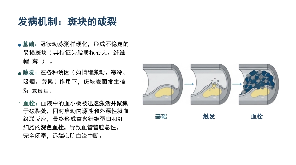 急性心肌梗死的急救与护理_第4页