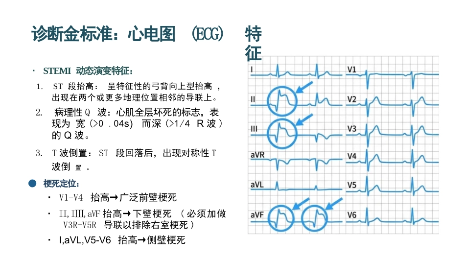 急性心肌梗死的急救与护理_第7页