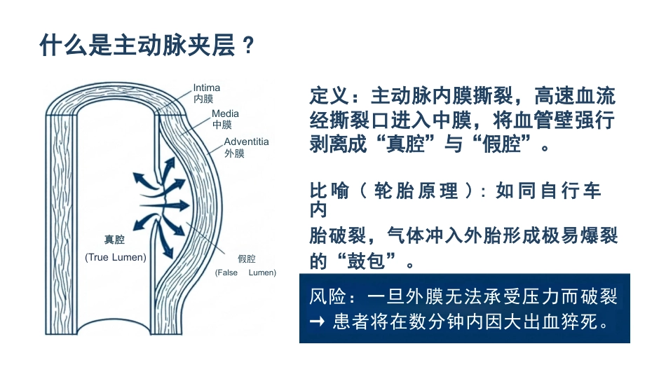 急性主动脉夹层护理查房_第3页