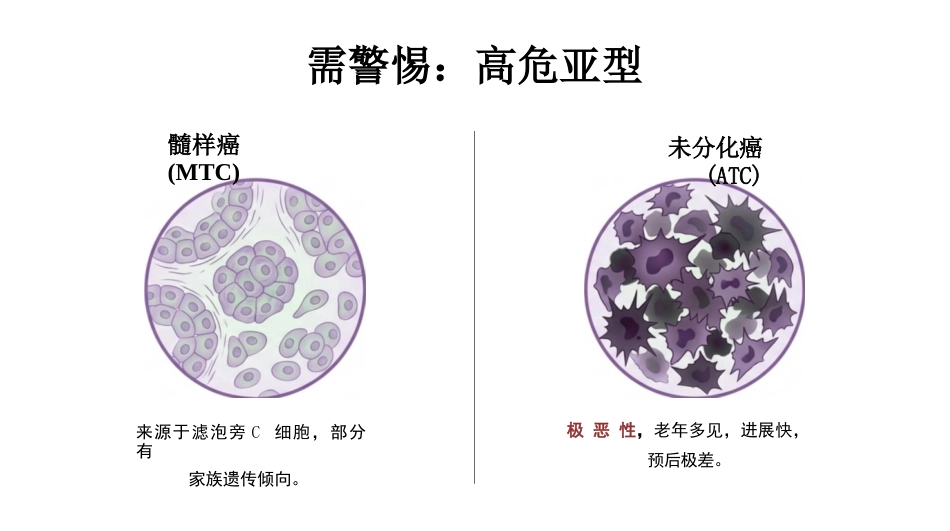甲状腺护理查房_第7页