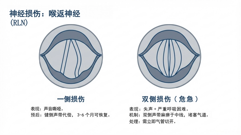 甲状腺切除术护理查房_第14页