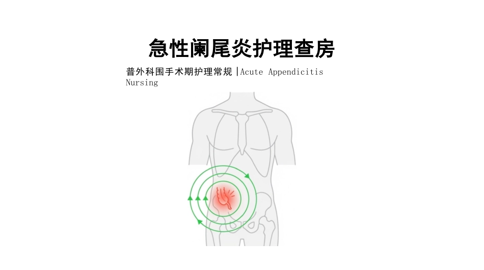 急性阑尾炎护理查房_第1页