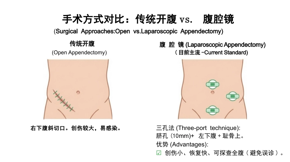 急性阑尾炎护理查房_第12页