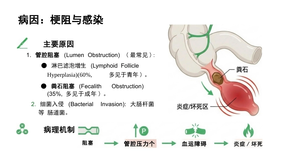 急性阑尾炎护理查房_第6页