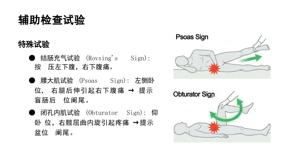 急性阑尾炎护理查房_第9页
