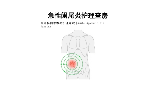 急性阑尾炎护理查房