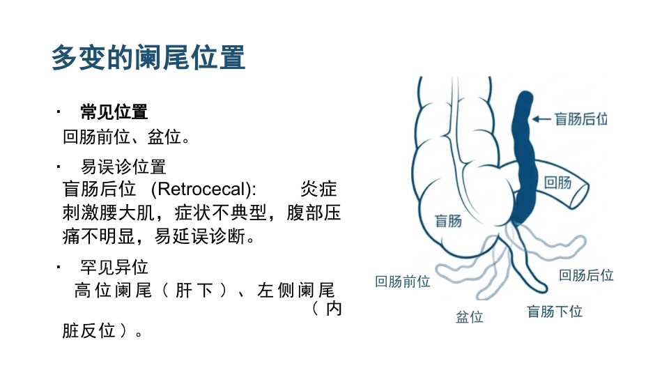 急性阑尾炎病人的护理_第5页