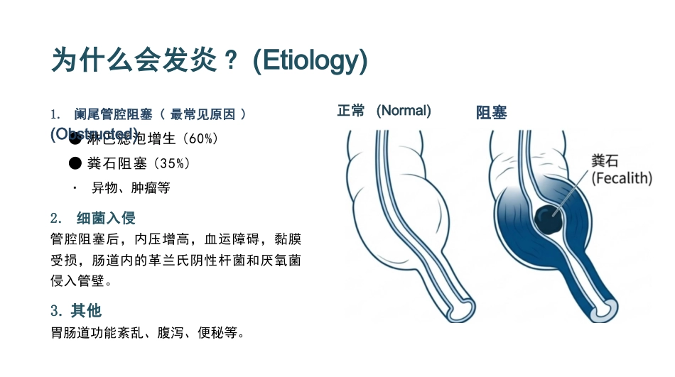 急性阑尾炎病人的护理_第6页