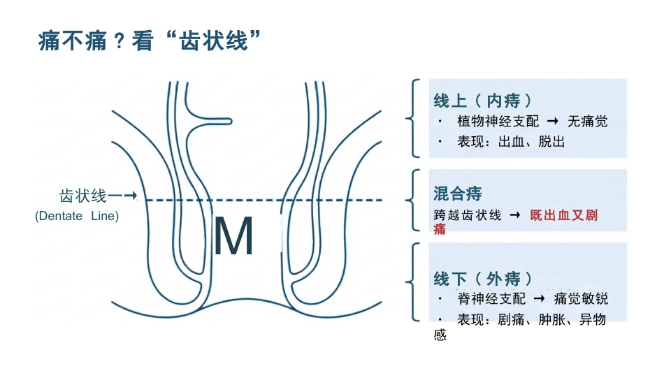 混合痔患者护理查房_第3页