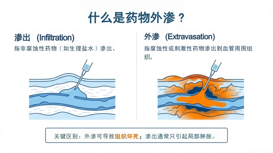 化疗药物外渗的紧急处理_第3页