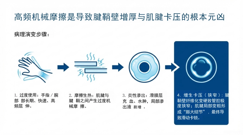 骨科狭窄性腱鞘炎护理查房_第4页
