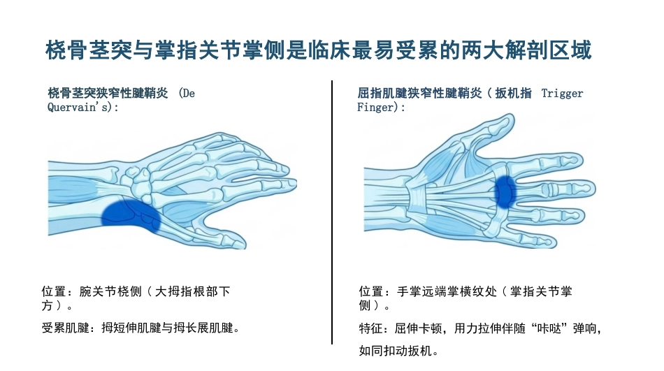 骨科狭窄性腱鞘炎护理查房_第5页