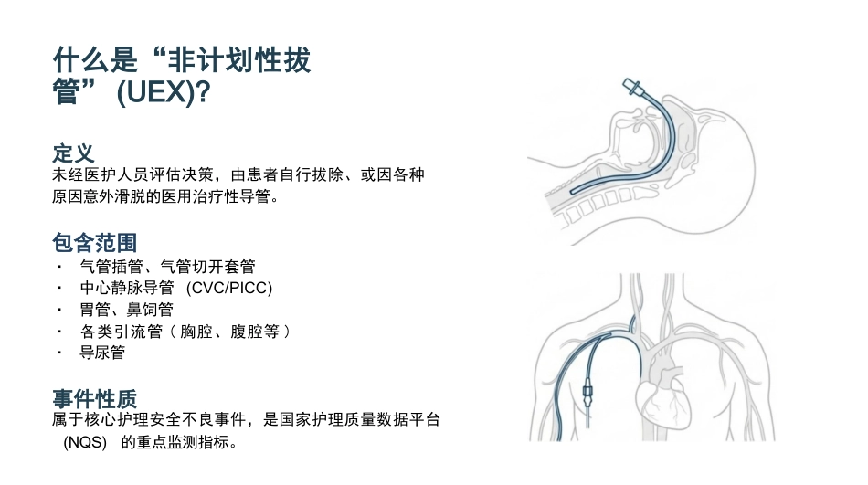 非计划拔管不良事件分析汇报_第3页