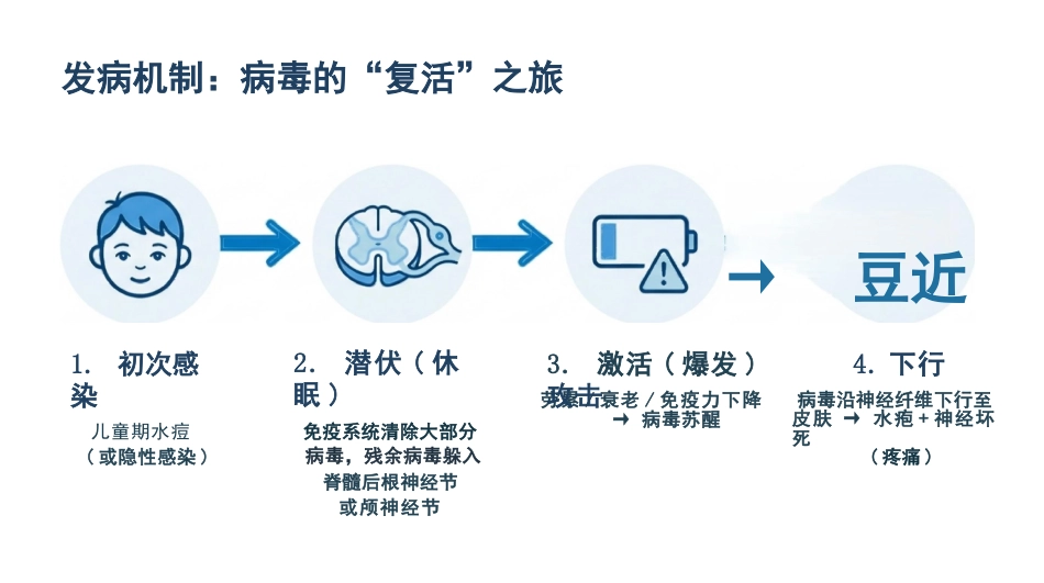 带状疱疹护理查房_第4页