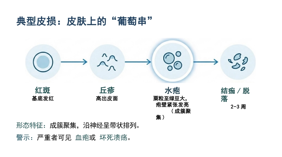 带状疱疹护理查房_第6页