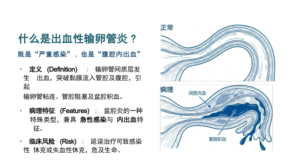 出血性输卵管炎护理查房_第3页