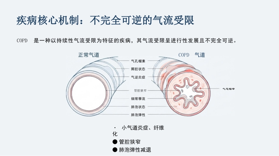COPD慢阻肺护理查房_呼吸康复与个案管理_第6页