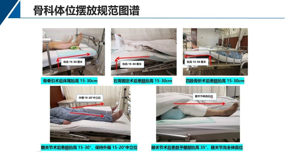 提高骨科病人体位符合率品管圈_第15页