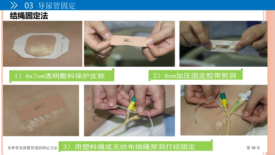 各种常见留置管道的固定方法_第10页
